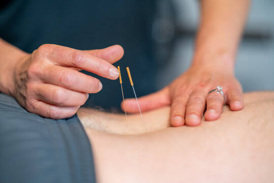 Dry Needling